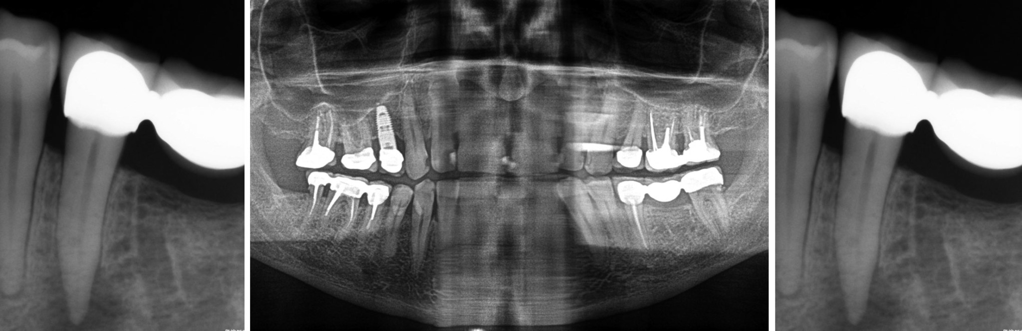 Comment choisir un cone beam