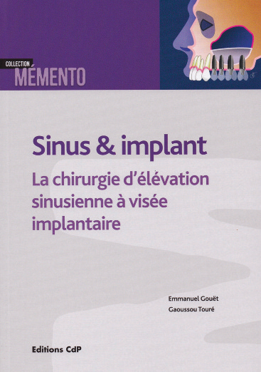 sinus et implant