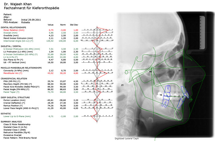 analyse-cephalometrique-laterale