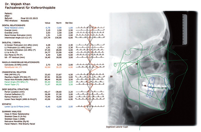 analyse cephalometrique laterale