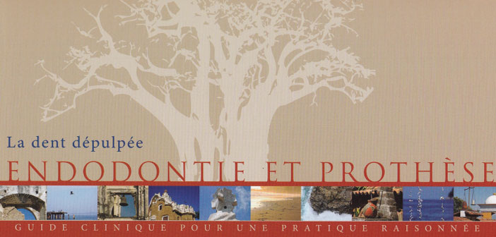 endodontie-et-prothese-la-dent-depulpee