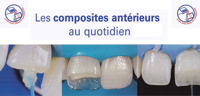 les-composites-anterieurs-au-quotidien