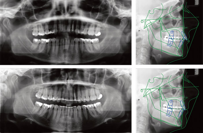 radiographie-initiale