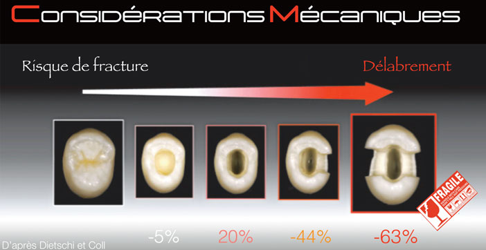 consideration-mecanique