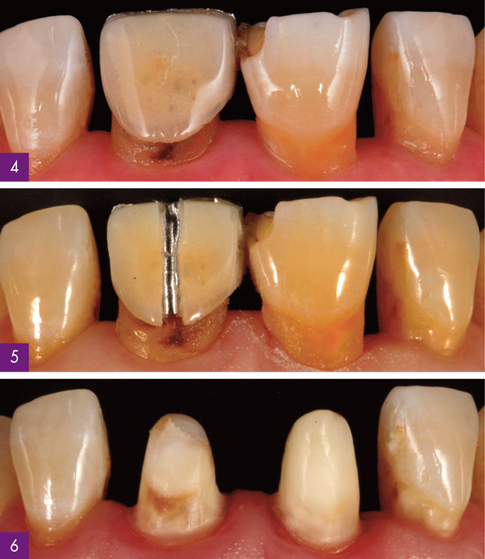 depose-preparation-phase-provisoire