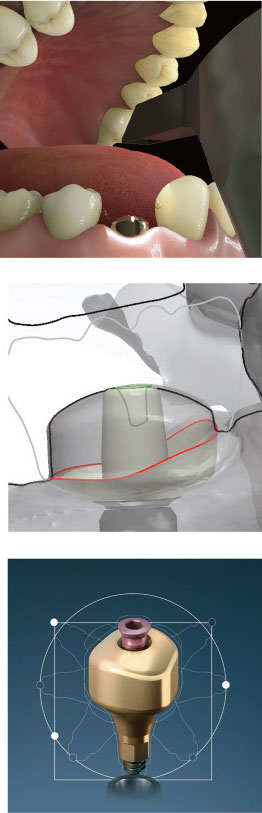 lrelation-dentiste-prothesiste-vue-par-lyra