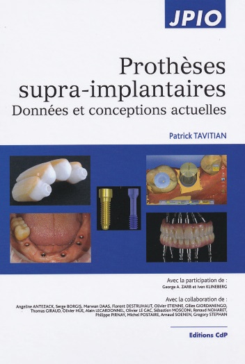 protheses supra-implantaires