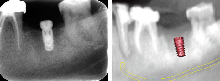 comparaison-de-la-radiographie