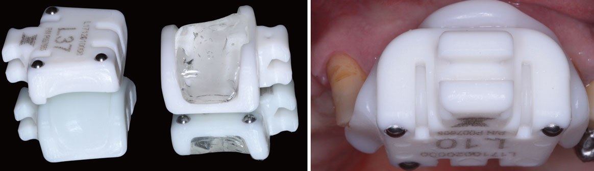 materiau-thermo-formable