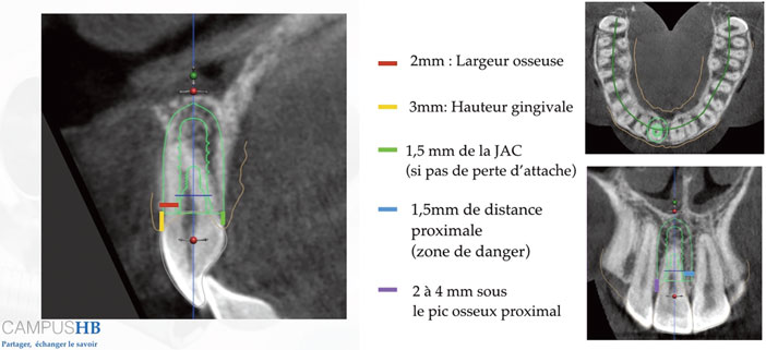 positionnement-tridimensionnel