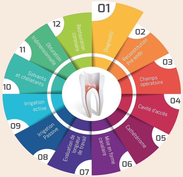 Deroulement du traitement endodontique