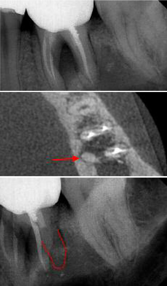 Radiographie-coupe-axiale-d-un-CBCT