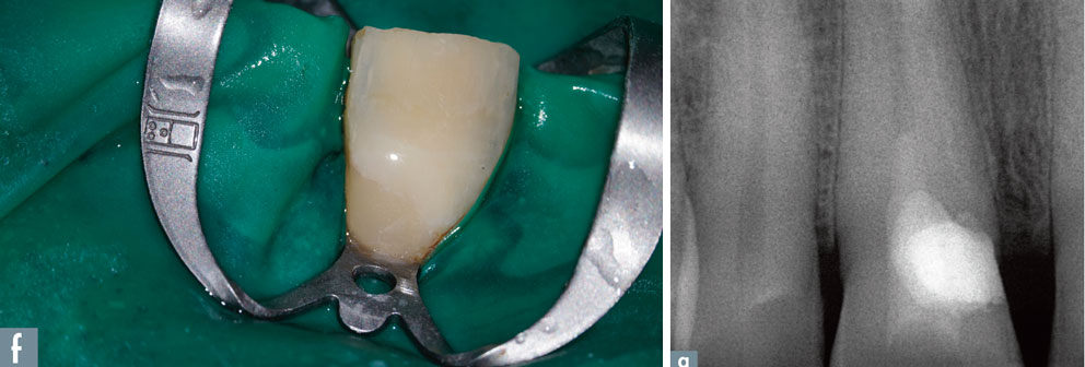 radiographie-post-operatoire