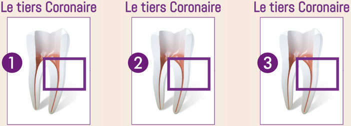 tiers-median-du-canal