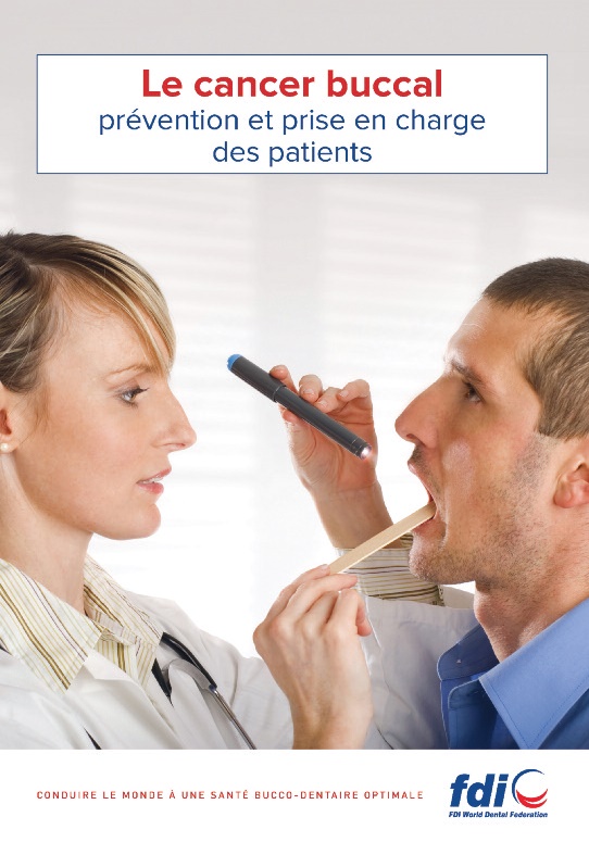 Prise en charge du cancer buccal