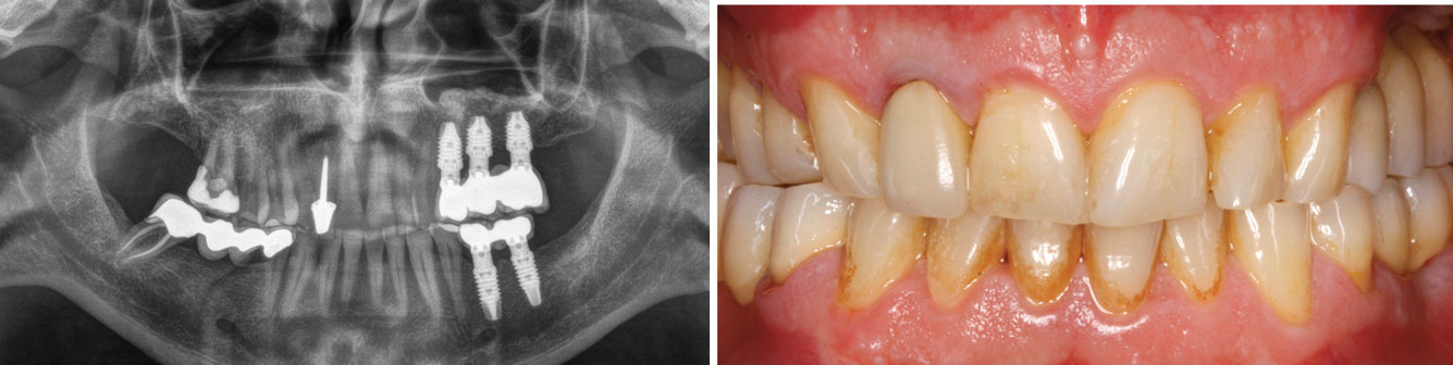 images-cliniques-et-radiographique