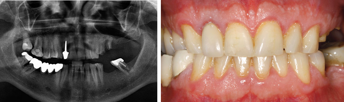 images-initiales-du-patient