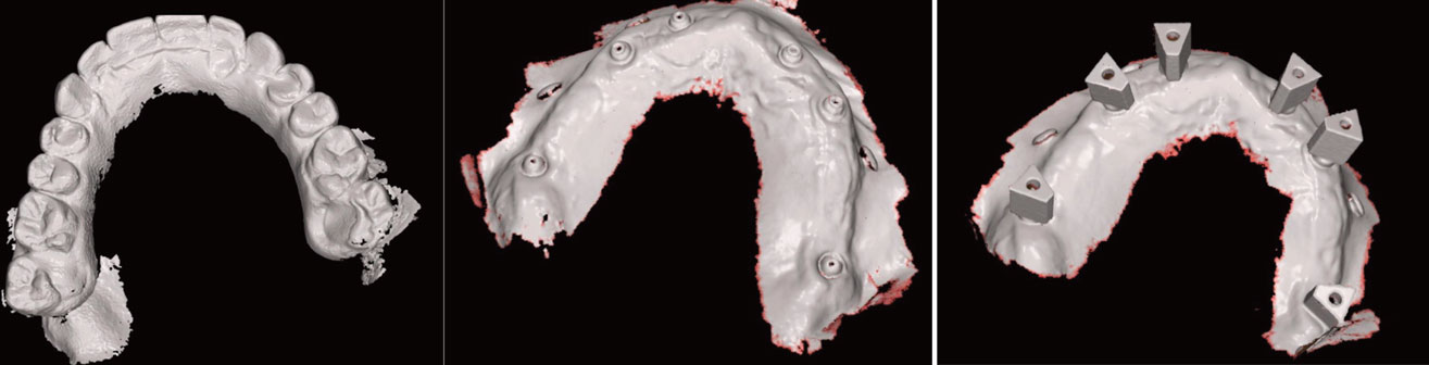 Plusieurs-numerisations-du-visage