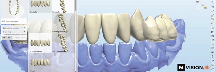 bibliotheque de dents