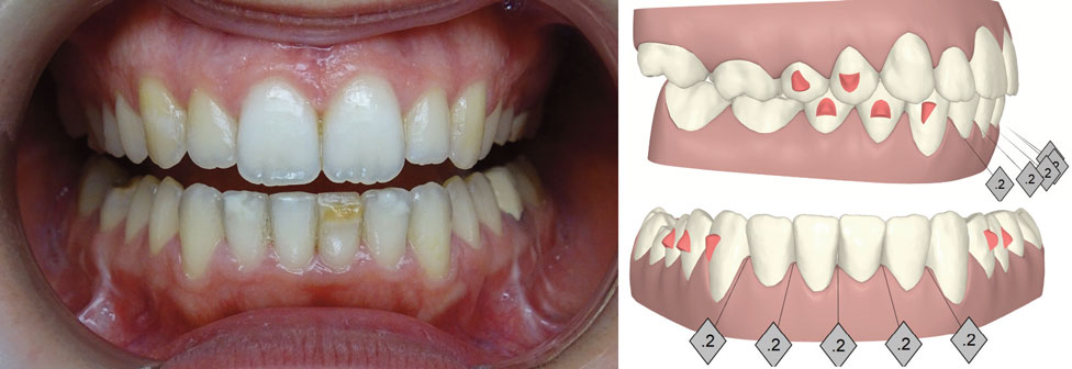 comparaison-avec-le-Clin-Check