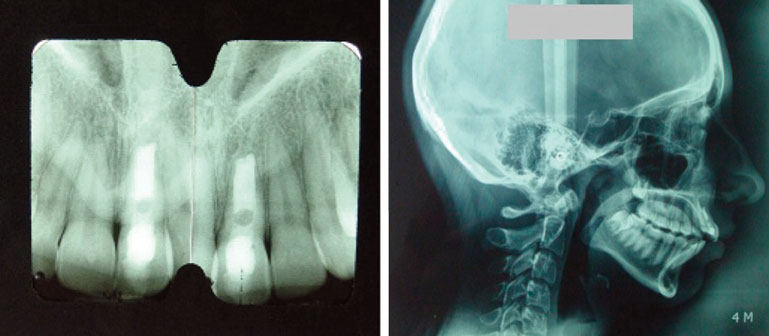 radiographie-de-depart