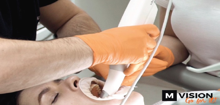 scanner intra-oral