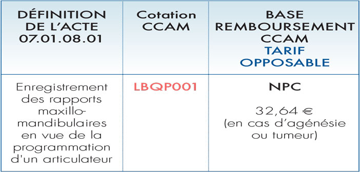 enregistrement-des-rapports-maxillo-mandibulaires