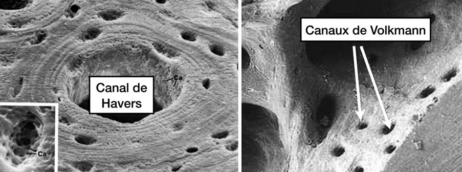 osteon-et-canal-de-Havers-en-microscope-electronique