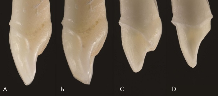 formes-de-preparation