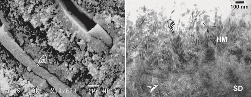 image-par-microscopie-electronique
