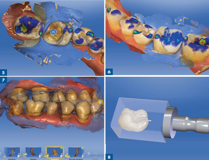 previsualisation-de-la-restauration