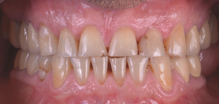 rehabilitation-complete