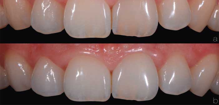 eclaircissement-externe