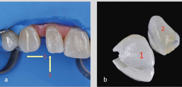 l ordre-d insertion-de-ces-deux-Chips-destines