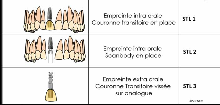 schema-explicatif-du-protocole