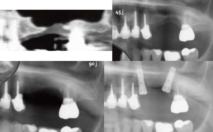 fig-2-abcd