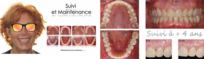 fig30-31