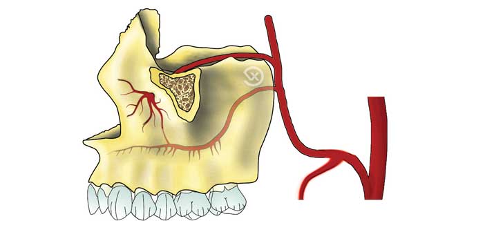 figure-3