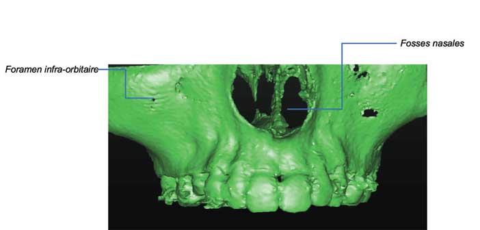 figure-3