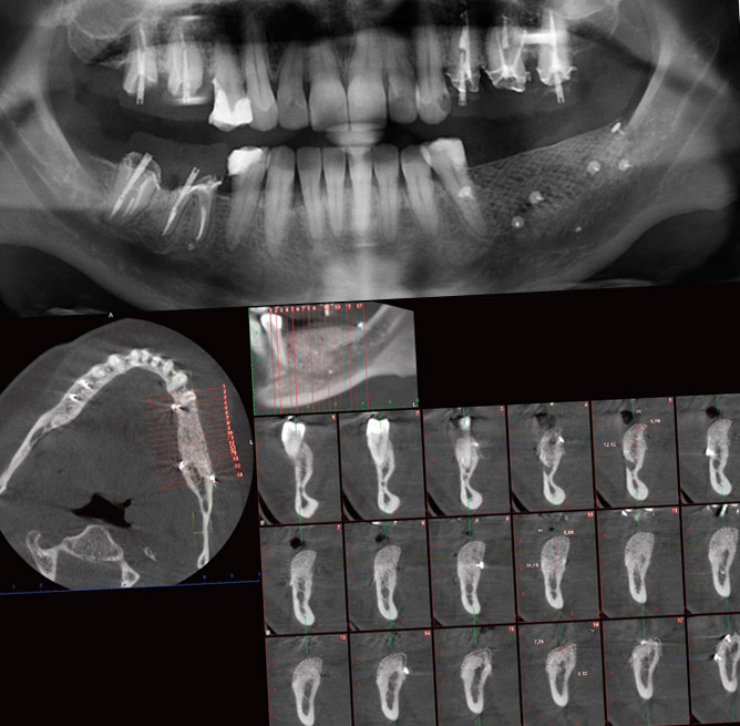 figure 11