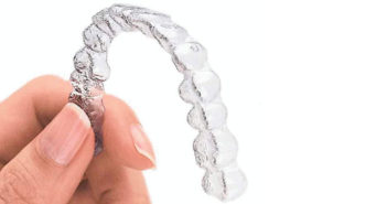Nouvelles fonctionnalités pour invisalign go plus invisalign