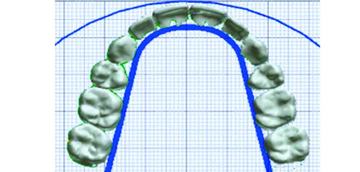 fig-12