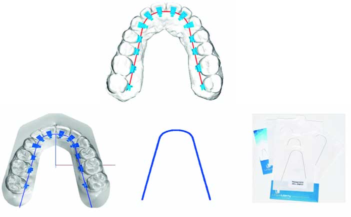 fig-13