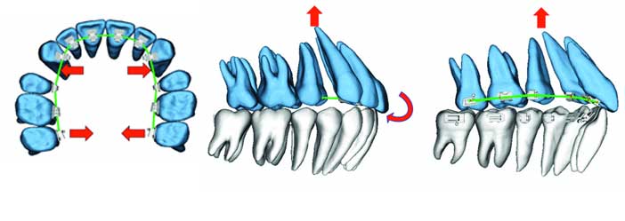 fig-14