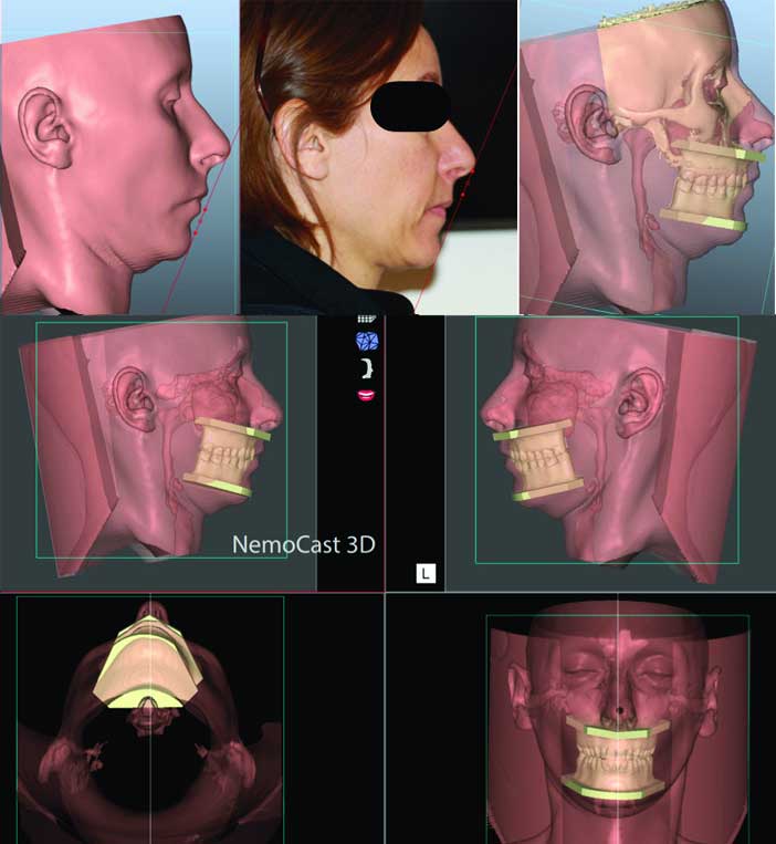 fig-2