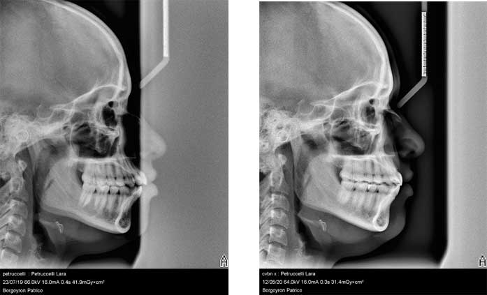 fig-3