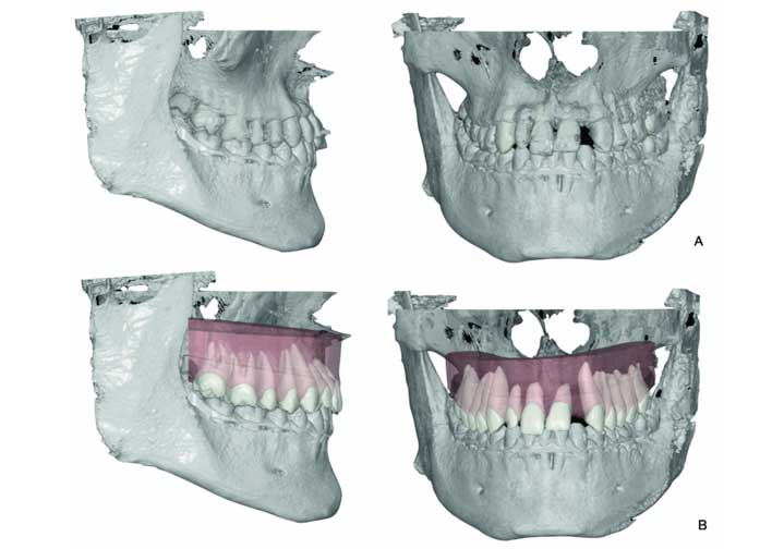 fig-4