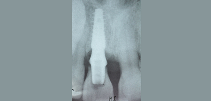 fig-15