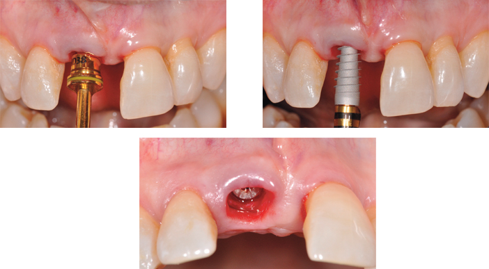 fig-4