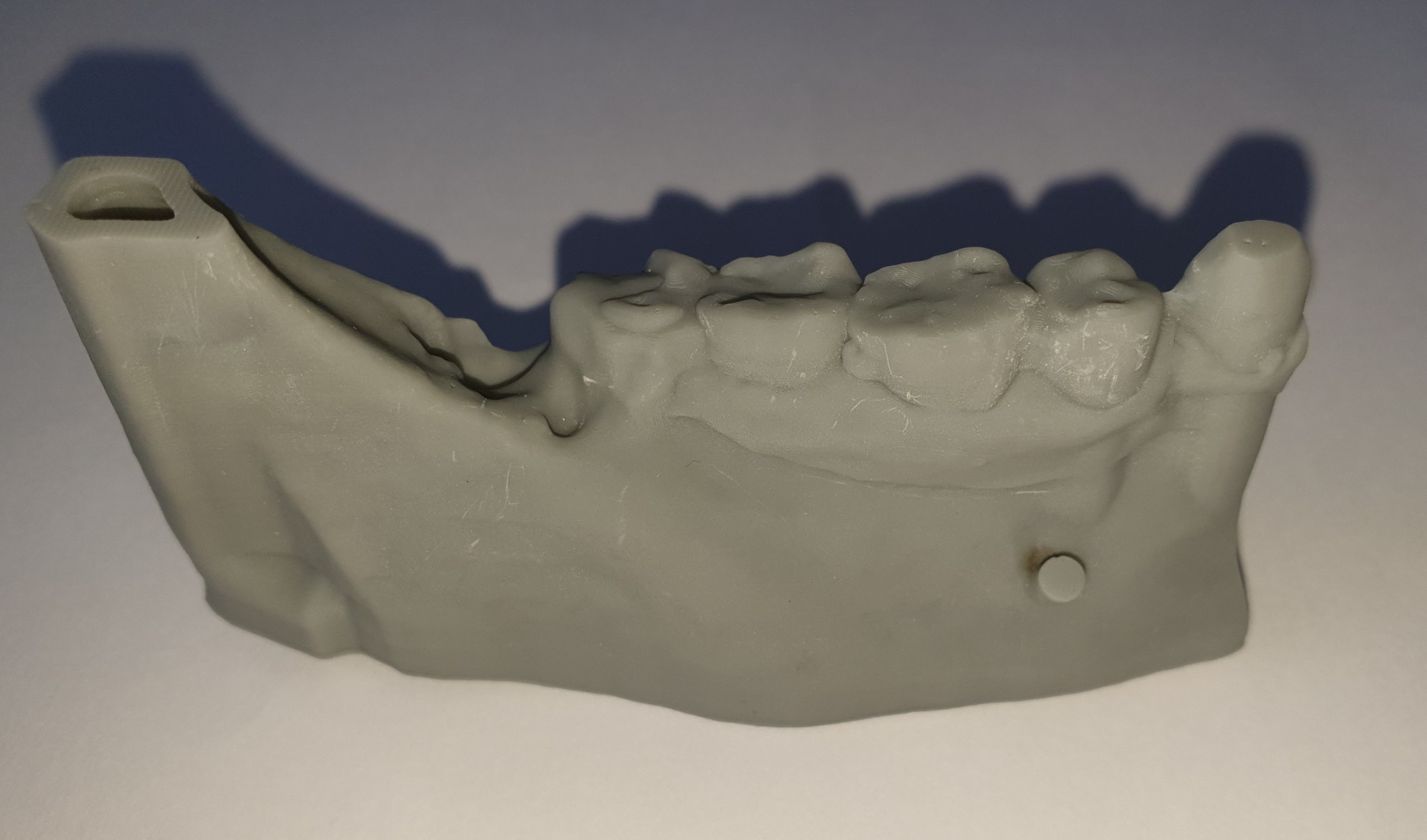 Kit D'ostéotomes Et Ciseaux à Os Pour Chirurgie Dentaire Et Greffe - Acier Inoxydable